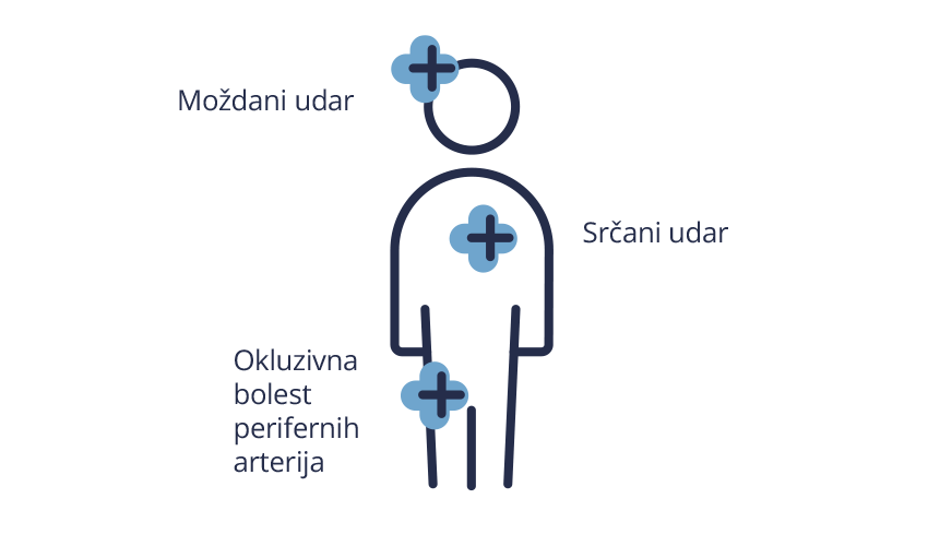 Čimbenici-Ateroskleroze