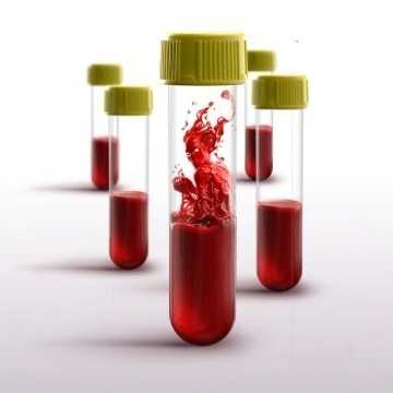 Lipoprotein-malo-lpa