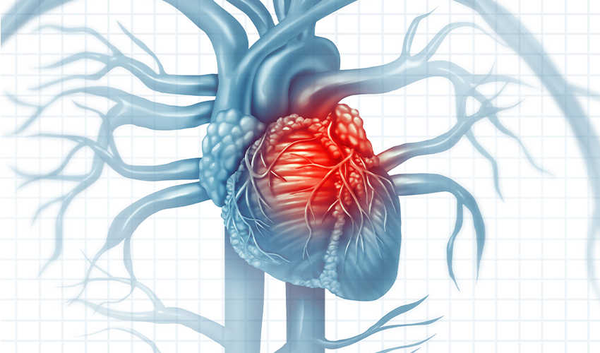Srčani-udar---850-x-500.jpg
