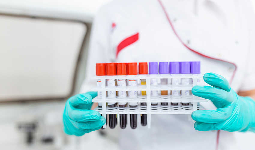  Krvne-pretrage---850-x-500.jpg 