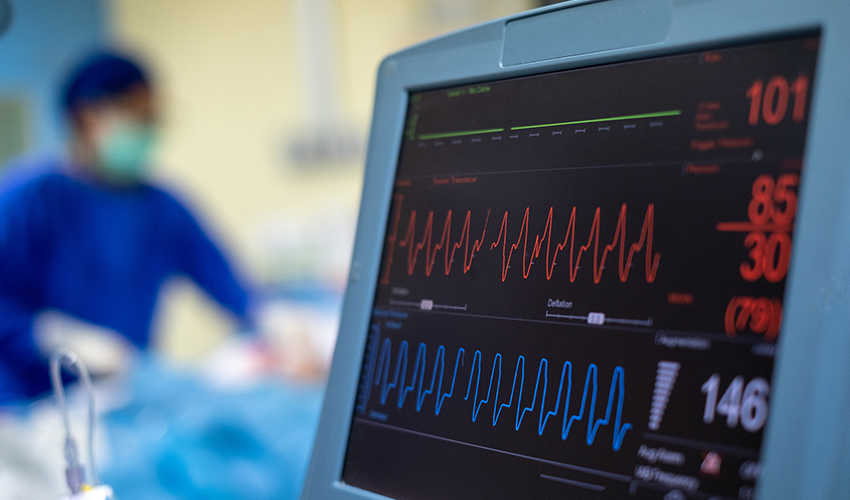 Elektrokardiogram-(EKG)---850-x-500.jpg 