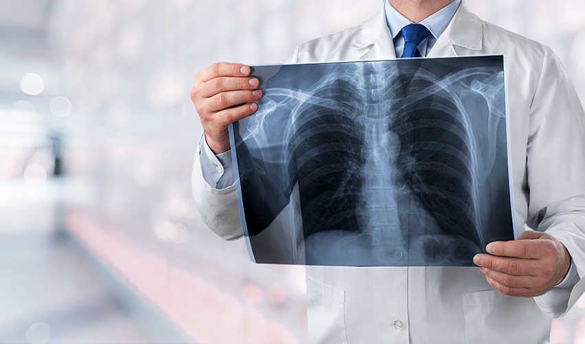 Rentgen-prsnog-koša---850-x-500.jpg 