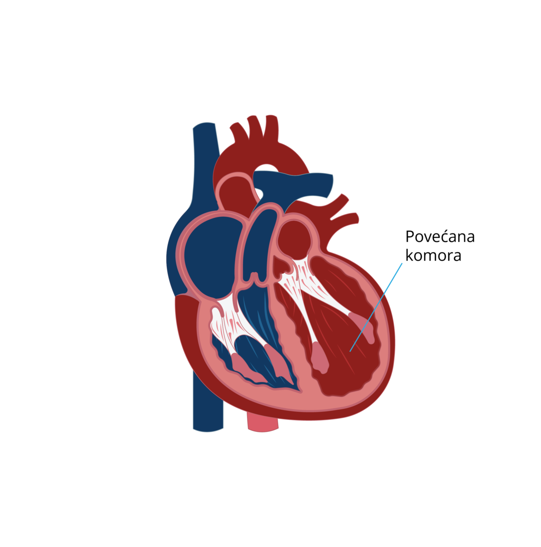 Oblici kardiomiopatija-06.png 