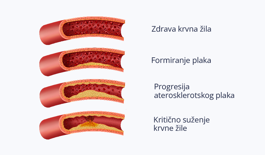 Krvne-Žile-Vizual