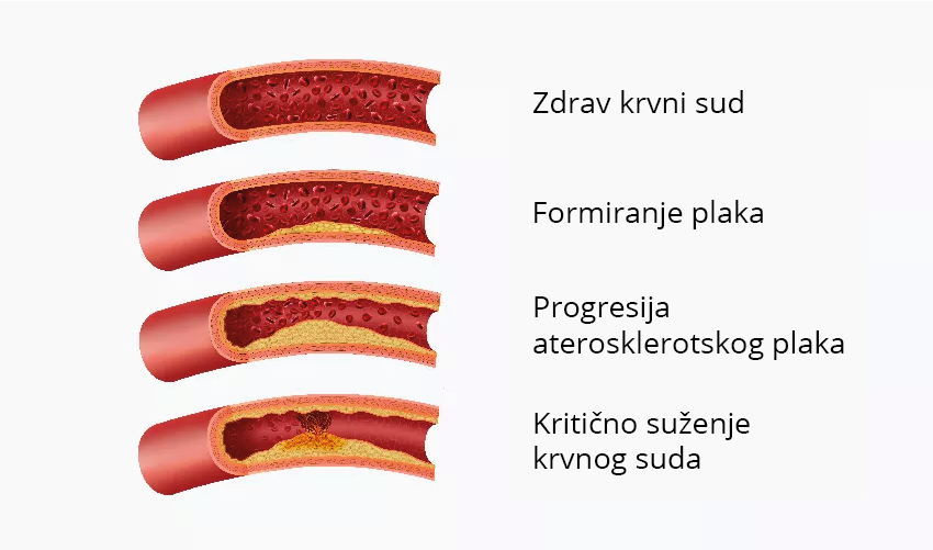 Krvni-Sudovi-Vizual-850-x-500.png 
